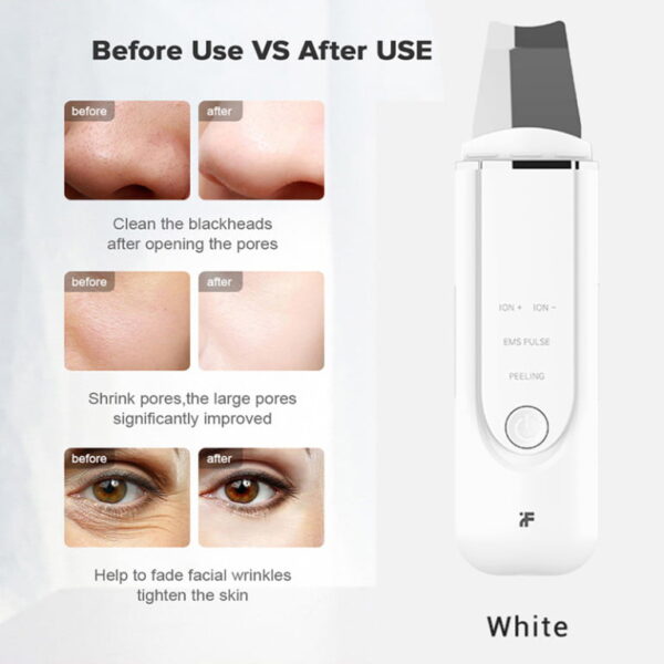 Ultrasonic Cleaner Xiaomi inFace MS7100 Skin Purifier Face Peeling - Image 4